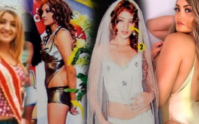 Estos son los famosos o artistas que se han hecho una rinoplastía