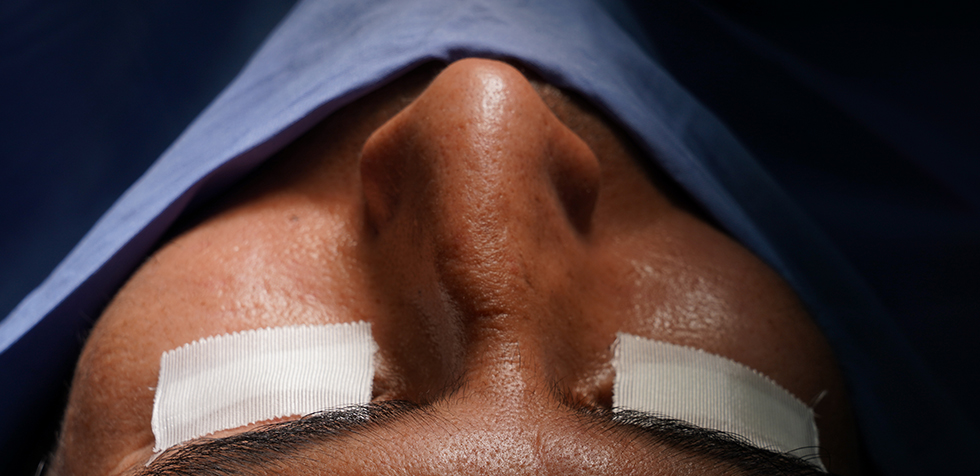 La hipertrofia en la cirugía de nariz: Septoplastía