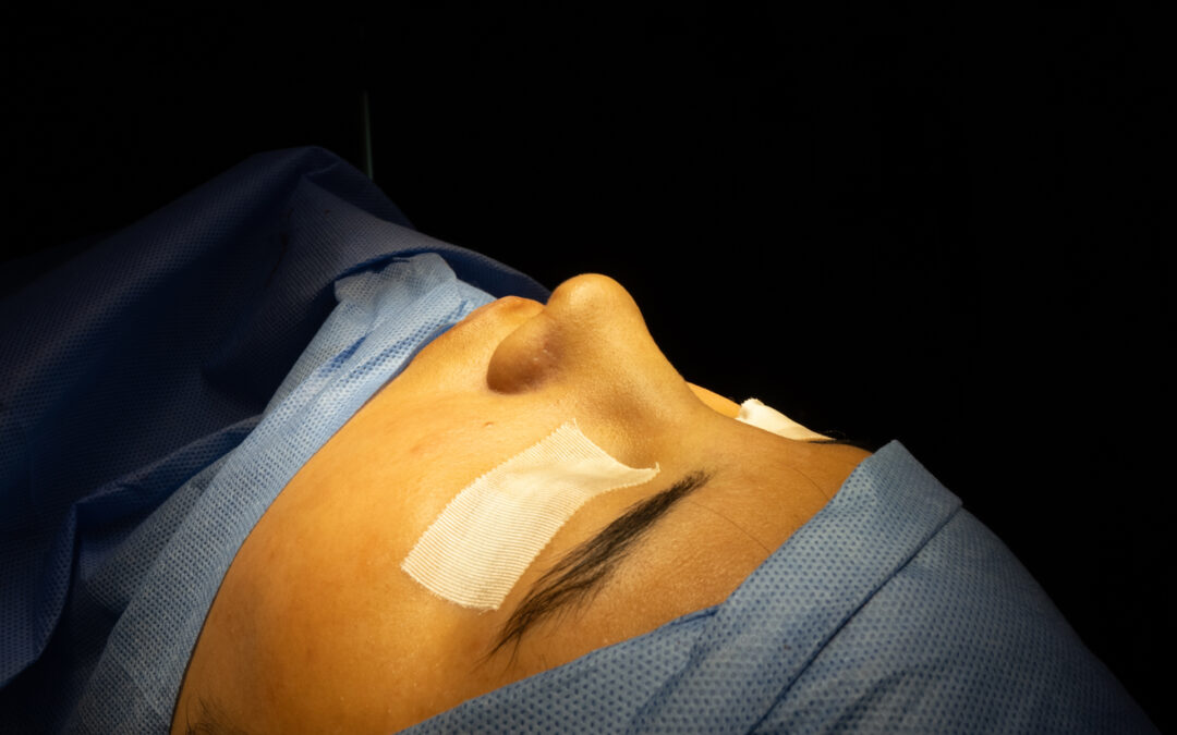 Clínica de rinoplastia en Lima