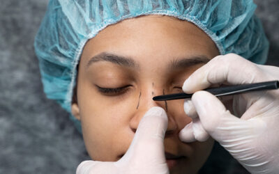 Procedimientos quirúrgicos para estilizar la nariz