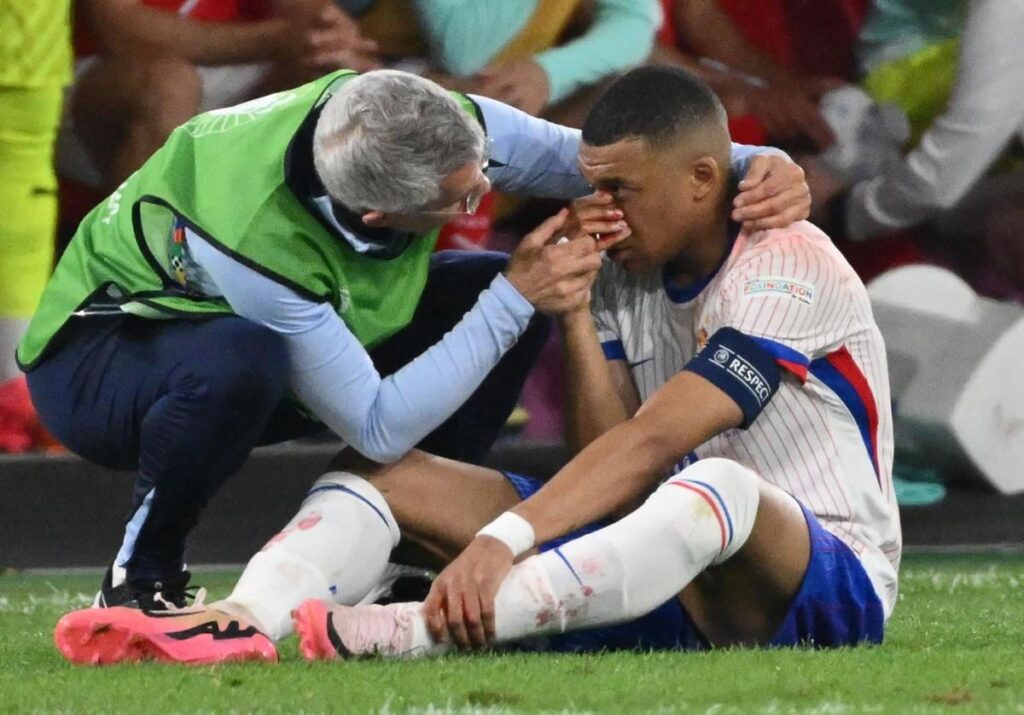 mbappe se rompe la nariz