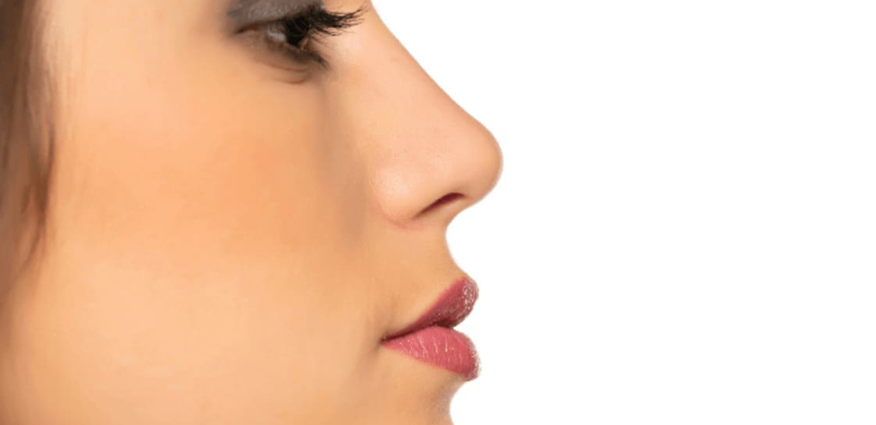 rinoplastia estética y funcional