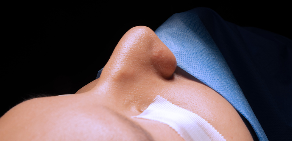 rinoseptoplastia