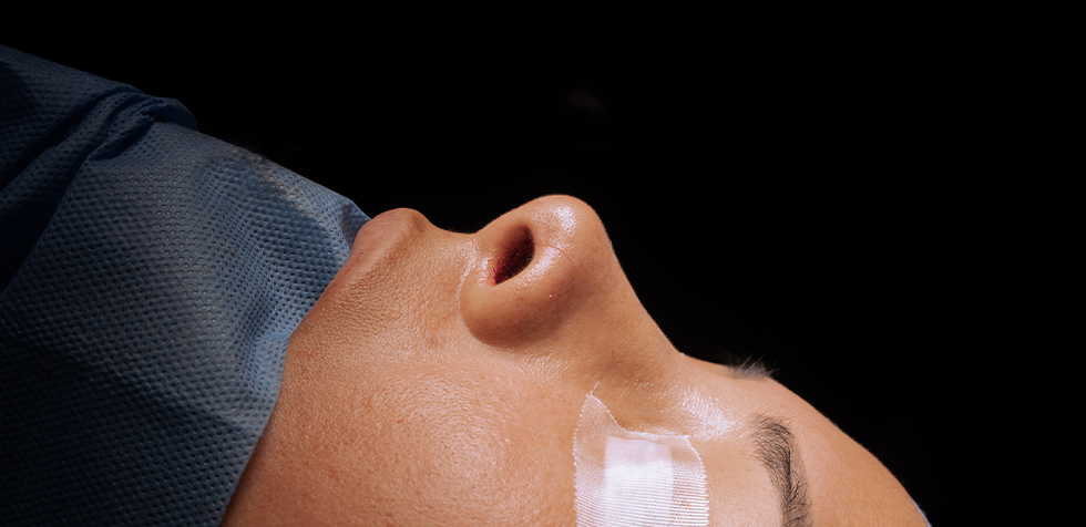 precio de la rinoplastia