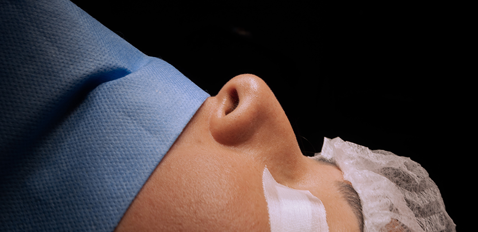 precio de una rinoplastia