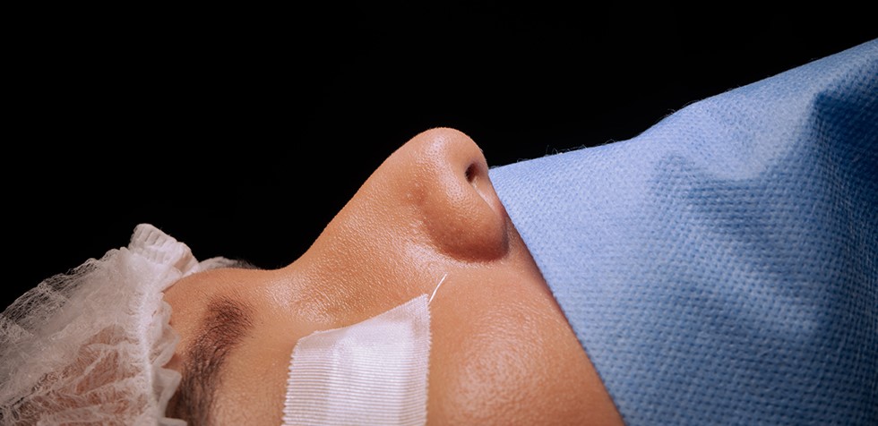 septorrinoplastia