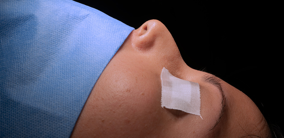rinoplastia peru