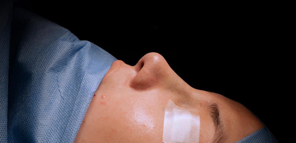 Rinoplastia ultrasónica con el Dr. Iván Guanilo