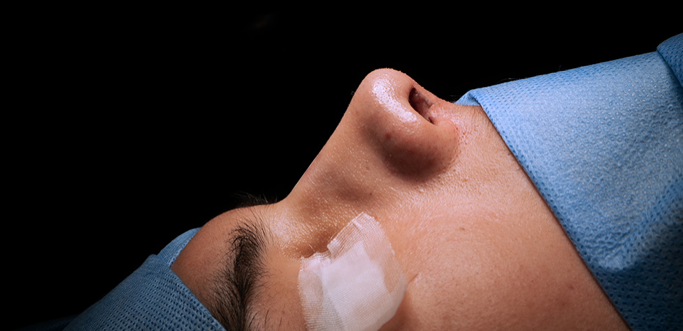rinoplastia precio