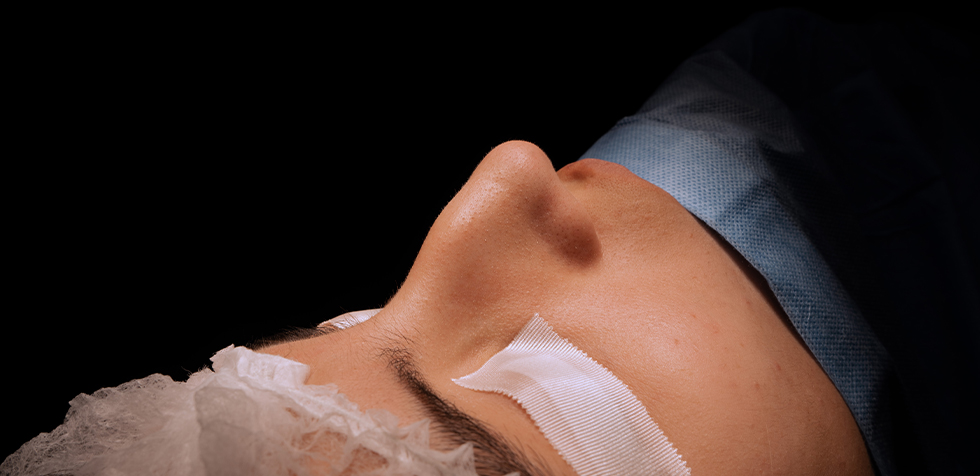 especialista en rinoplastia lima