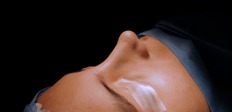 especialista en rinoplastia