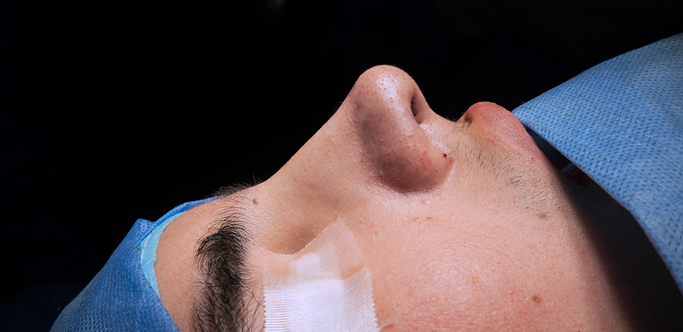 rinoplastia ultrasonica