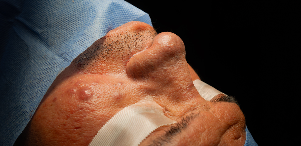 Clínica de rinoplastia