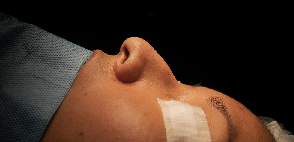 precio de la rinoplastia