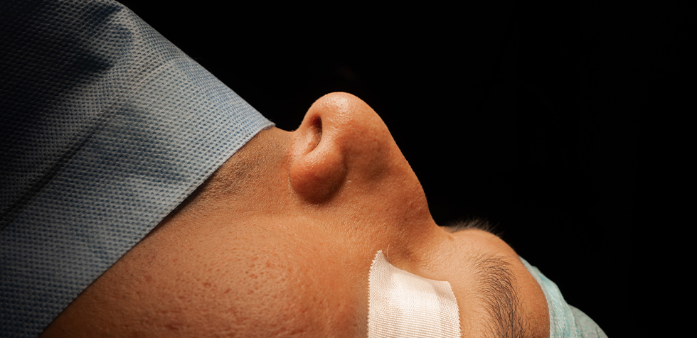 El mejor cirujano plástico en rinoplastia