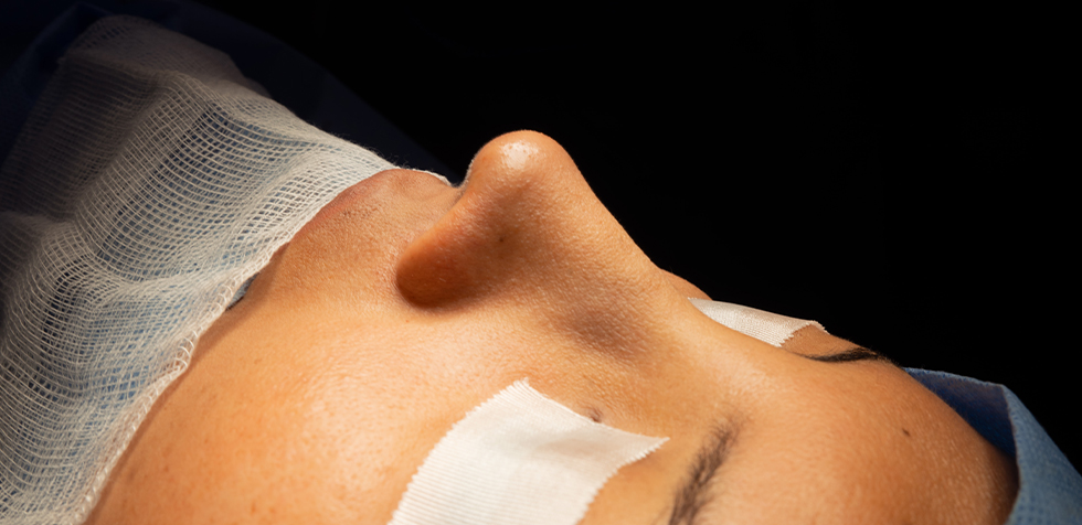 rinoplastia con piel delgada
