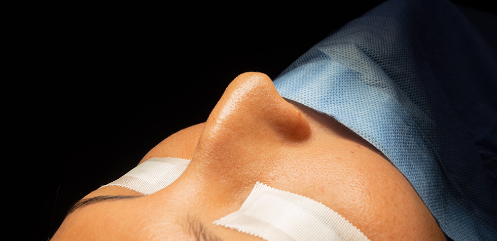 precio de rinoplastia