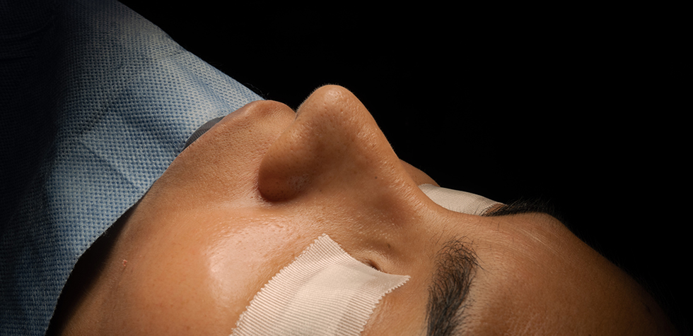 mitos de la rinoplastia