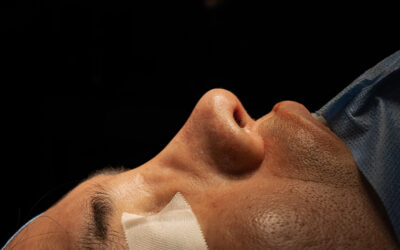 Rinoplastía abierta y cerrada