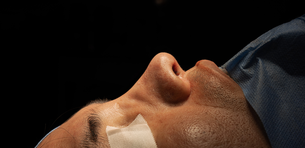 precio de una rinoplastia