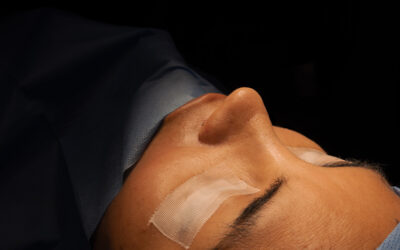 Mitos y verdades de la rinoplastia