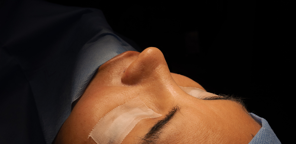 Cuidados de la piel tras una rinoplastia