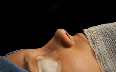 Cómo acelerar la cicatrización después de una rinoplastía