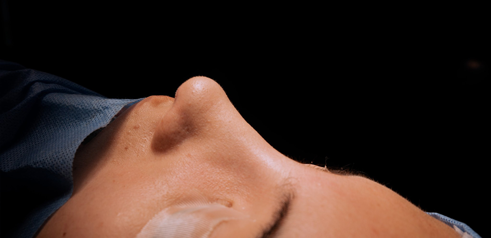 rinoplastia ultrasonica precio