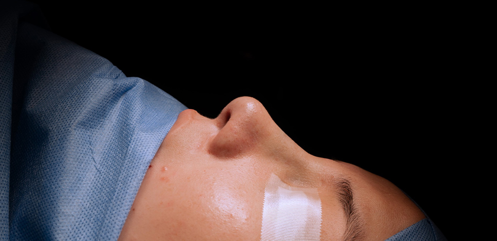 precio de rinoplastia ultrasonica