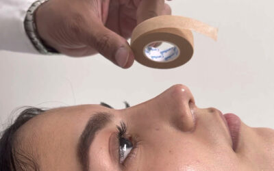 Cinta micropore en una rinoplastia: por qué es clave y cuánto tiempo debes usarla