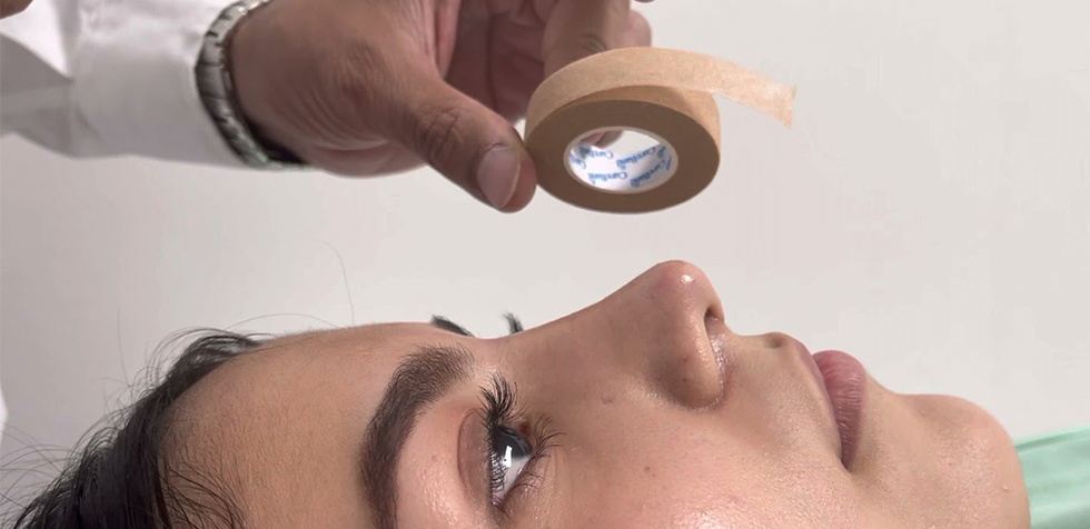 Cinta micropore en una rinoplastia: por qué es clave y cuánto tiempo debes usarla