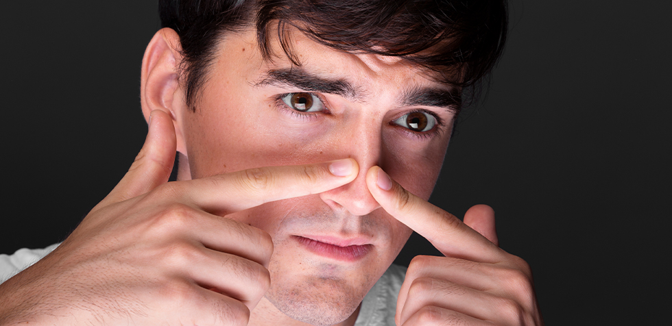 rinoplastia: callo nasal