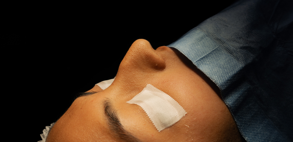 rinoplastia ultrasonica precio