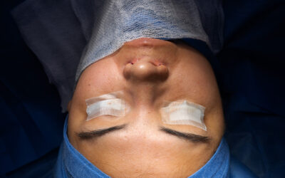 Rinoseptoplastía: mejora estética y funcional de la nariz en una sola cirugía