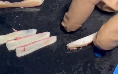 Rinoplastia con cartílago de costilla, septum y de oreja: ¿Cuál es mejor?