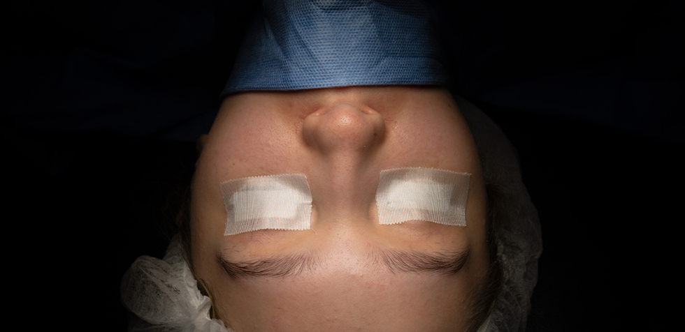 rinoplastia ultrasonica
