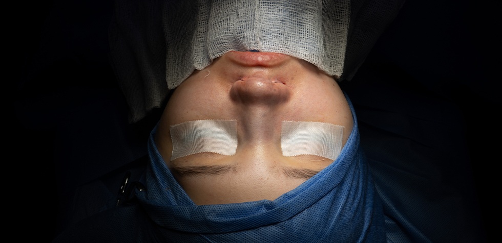 candidato a una rinoplastia