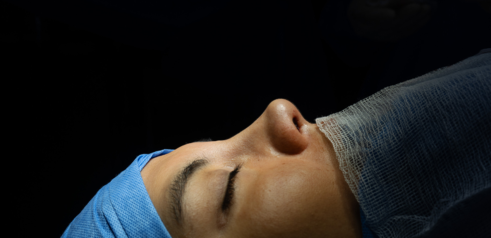 dr guanilo: rinoplastia ultrasonica