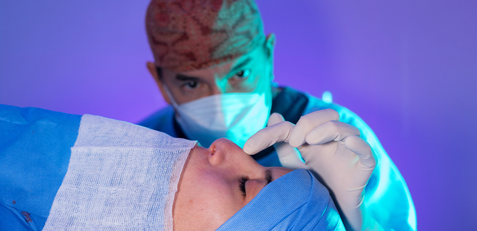 rinoplastia antes