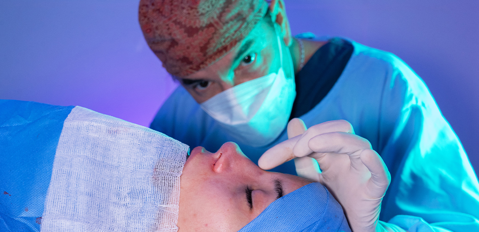 rinoplastia peru recuperacion rinoplastia