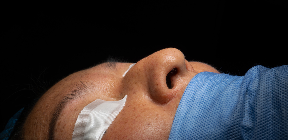 el mejor cirujano de rinoplastia